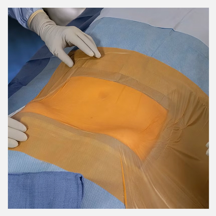 cbbaac77-5f53-43dc-91c9-9ce3b2dfc441.webp Surgical Incise Film