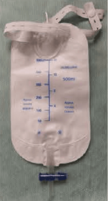 dfb87c0e-d978-4ccf-bbcf-959d9a5c2f0e.png Urine Collection Bag